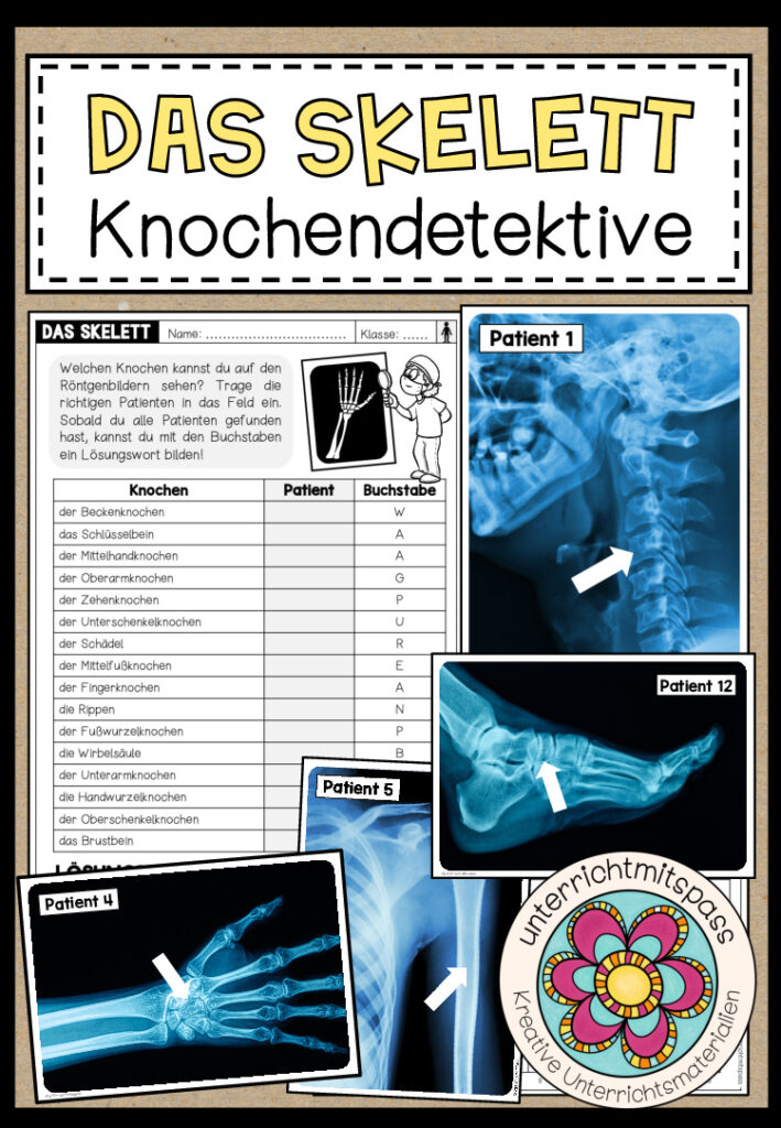 DAS SKELETT – KNOCHENDETEKTIVE